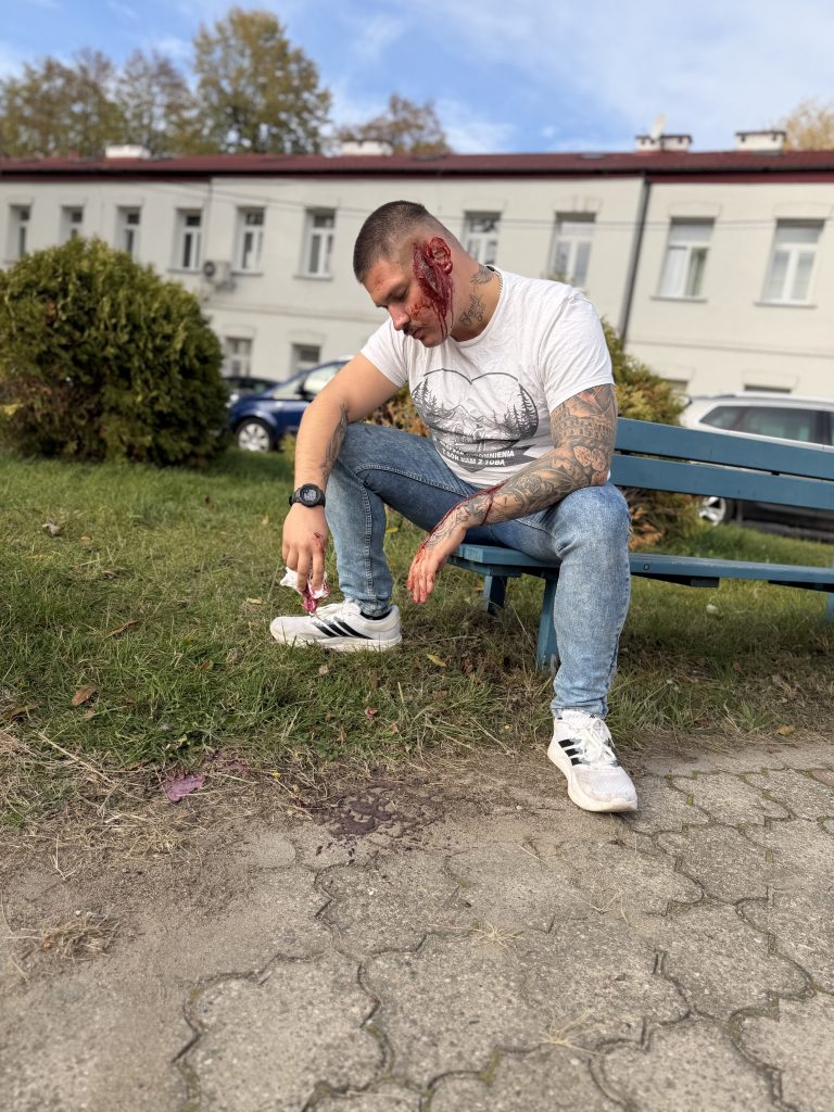 Studnia siedzi na ławce przed budynkiem uczelni ze sztuczna rana na twarzy