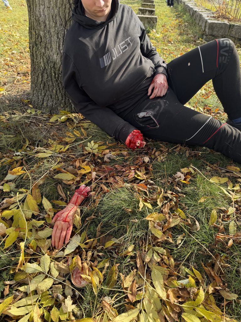 odcięta dłoń leży na trawniku, a obok poszkodowany
